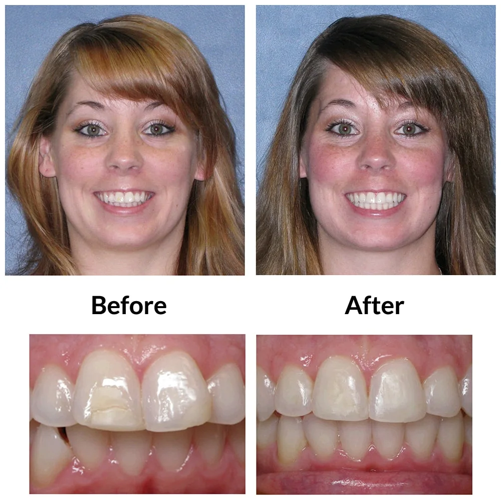 Adult2-before-final-photo