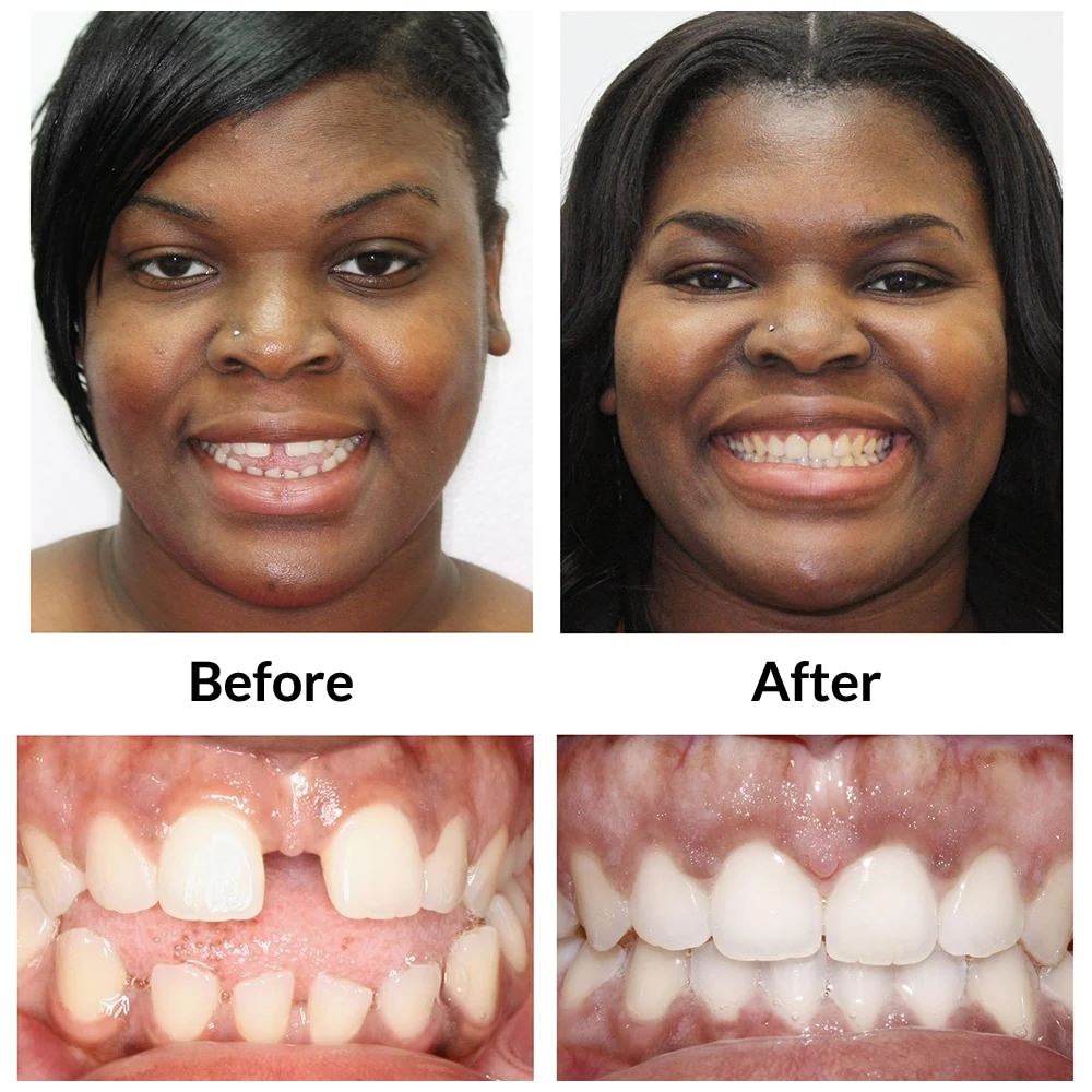 Adult3-before-final-photo
